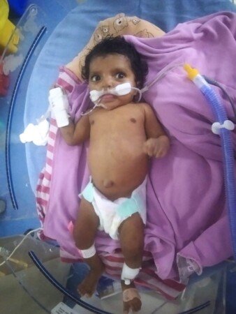 ప్రాణాపాయ స్థితిలో పసిపాప…